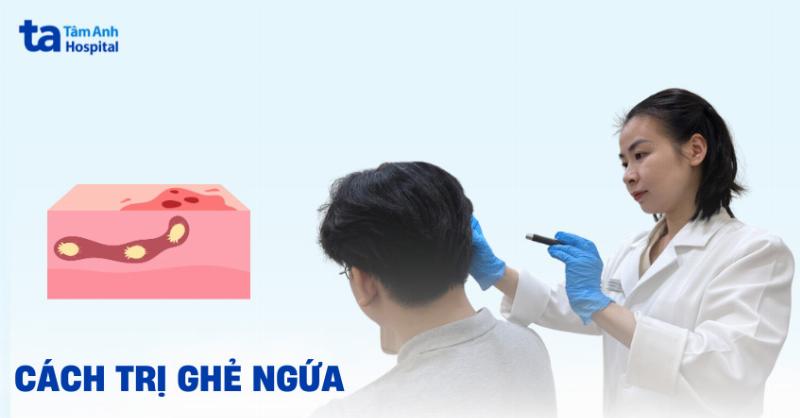 Phong ngua va tri nhen do bang phuong phap an toan hieu qua